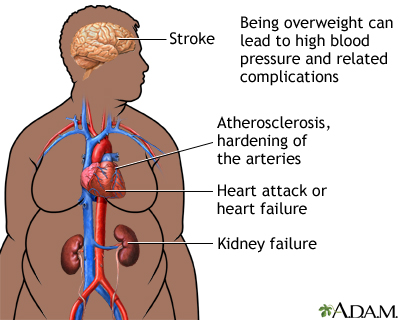 Complementary And Alternative Medicine High Blood Pressure