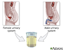 Urine test